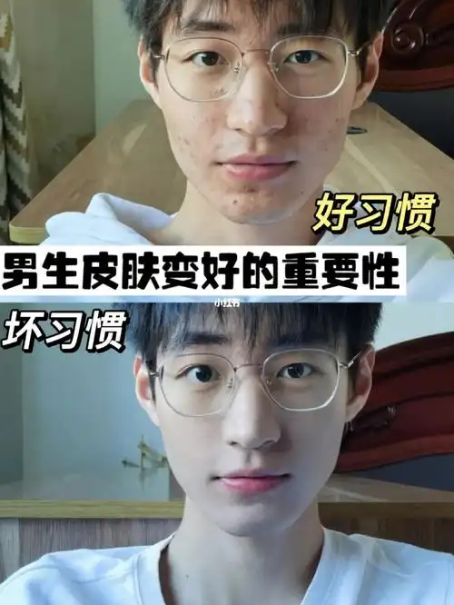男生皮肤好坏真的很重要75这18条你要记住