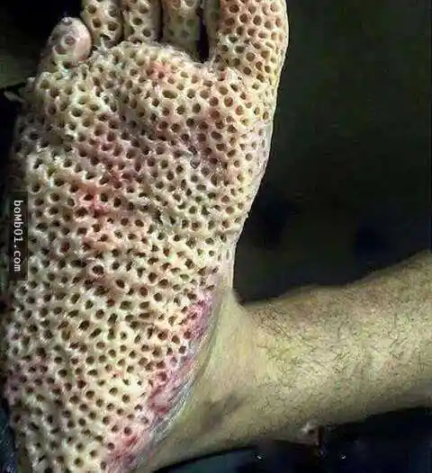 密集恐惧症患者会很想死的图片,最后一张害我差点就要送医啊!