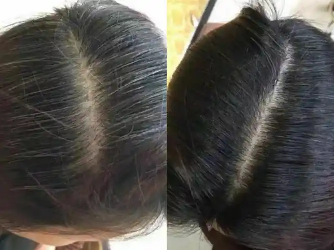 世代专业调理白发问题的医馆,在不到两个月的时间里,满头花白头发竟然