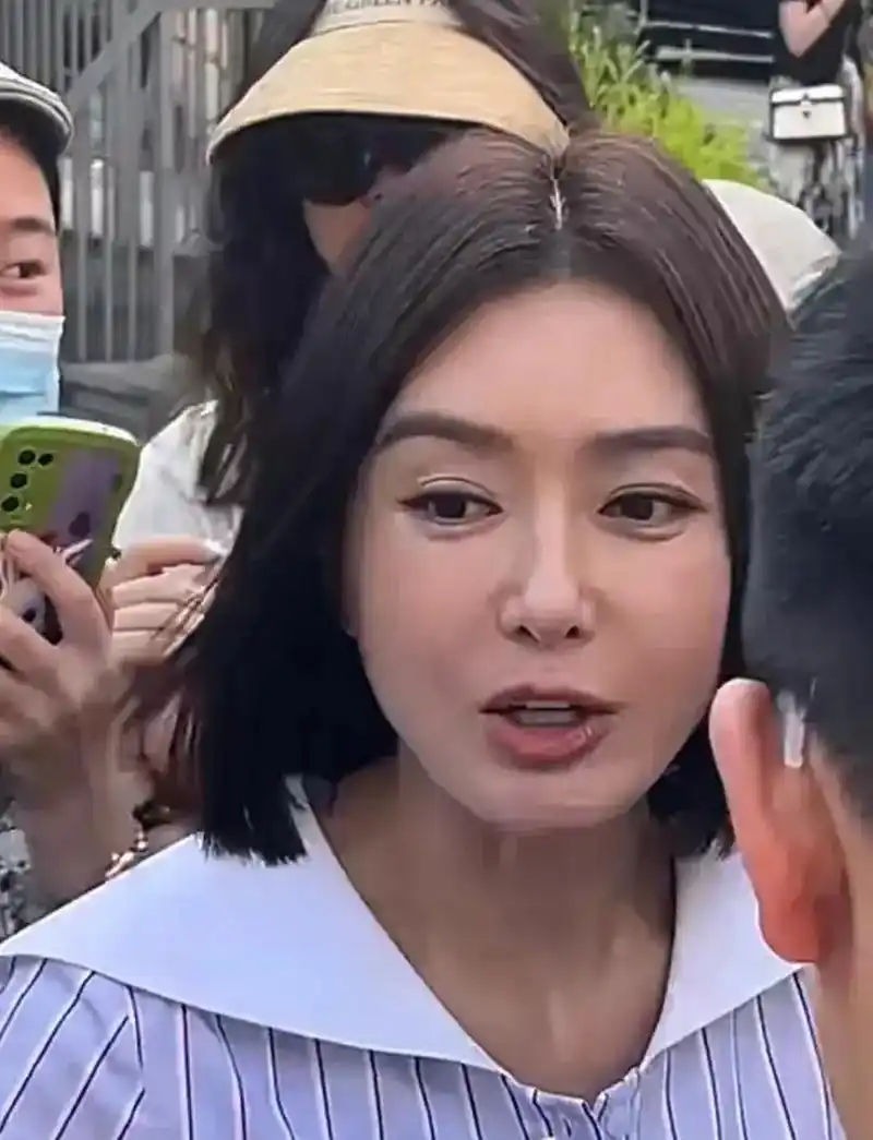 秦岚生图的脸有点僵硬,这是医美做多了吗?