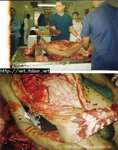 大连尸体加工厂探秘