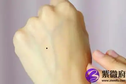 手背上长痣象征什么寓意 手背有痣财运好吗?