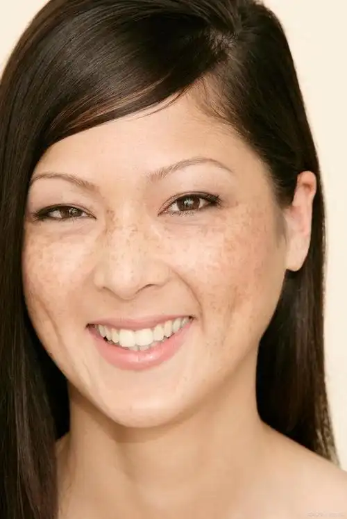 高效祛斑套装,让你在夏季弯道超车,白白嫩嫩度夏日