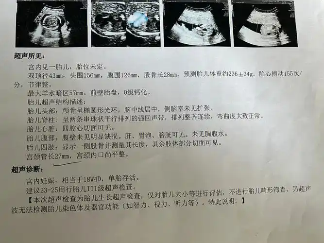 闯关2|宫颈长度恢复正常!涨涨涨