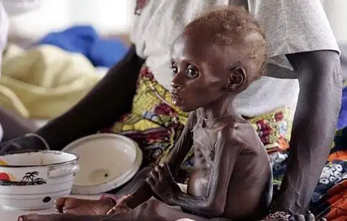 饥饿会默默的跟在游客的身后,等待着可能会有游客给他们食物但是非洲