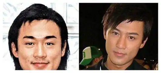 杨幂杨颖鞠婧祎整容并非女明星专属成龙秦昊这样的影帝都动过