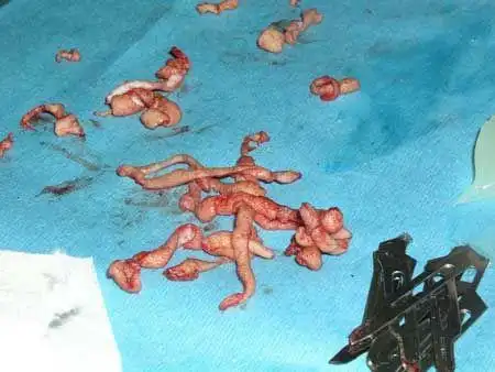 太恐怖了!现场实拍残忍的人体肉雕全过程(组图)