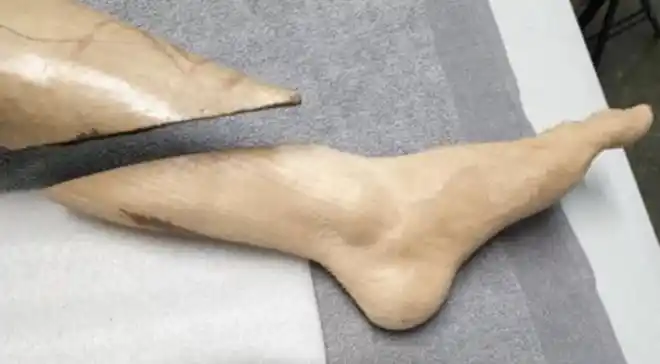 菜市场惊现被啃过的人脚警方追查下发现这只脚竟涉及4起命案