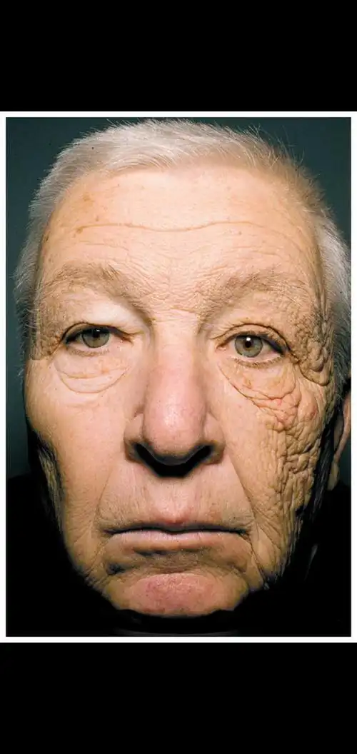 3加速导致皮肤衰老的原因及其解决方案