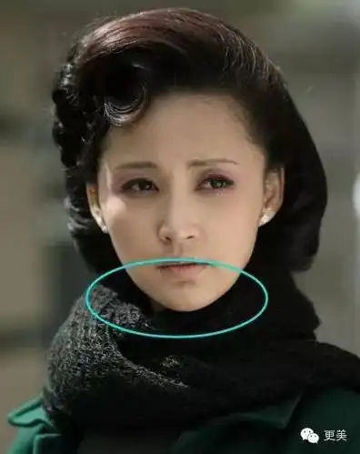 张歆艺的下巴真的是假的吗童年照说明了一切