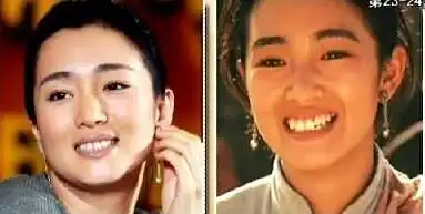 巩俐整牙虎牙做烤瓷牙的前前后后