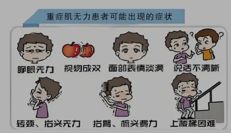 重症肌无力的临床表现