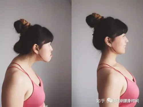 【毛毛】脖子前倾还有救吗?全网最完整的教程! - 知乎