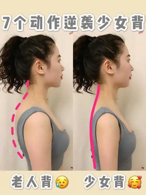 步骤1: 每天7个动作改善颈部前倾 缓解驼背