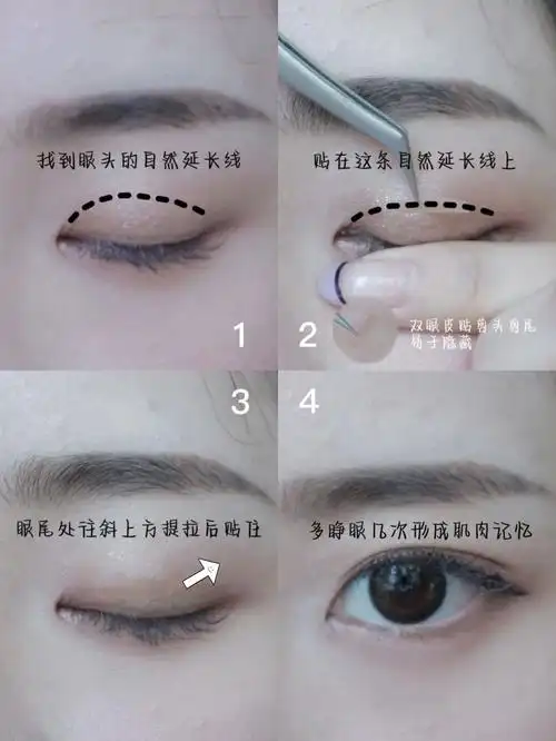 零失误超自然7577单眼皮肿眼泡双眼皮贴法