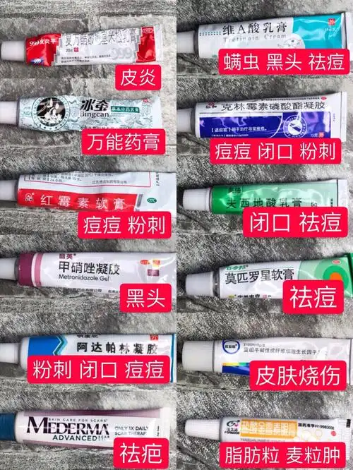 皮炎痘痘螨虫闭口粉刺黑头疤痕脂肪粒麦肿粒皮肤烧伤药膏合集