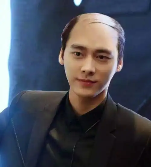 为什么很多秃顶的人,宁可留周围一圈头发,也不直接剃成光头?