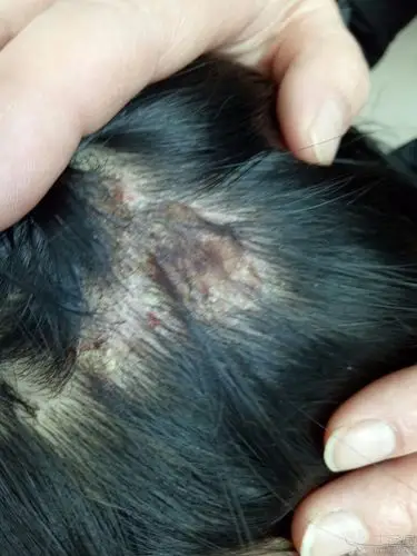 大家帮忙看看这是啥病,5天了,开始很小一块