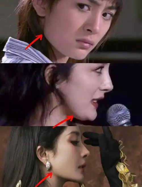 杨幂下颌角变化解析