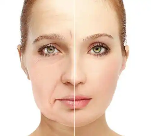 脸部皮肤松弛?试试这个办法