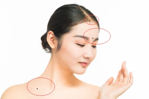 女人身上痣的位置与命运这几处痣最好留着