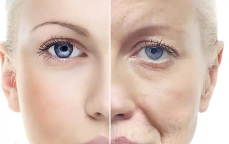 40岁后面部松弛下垂远不是你看到的皮肤表面这些皱纹