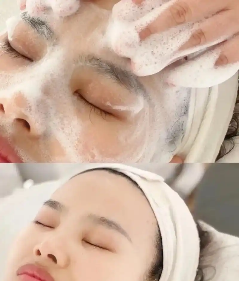 面部清洁补水.00为什么天热痘痘就爆发? 因为气温升高皮肤油 - 抖音