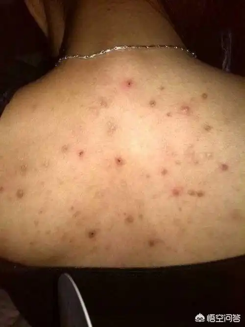 硫磺皂怎么用,有什么用?