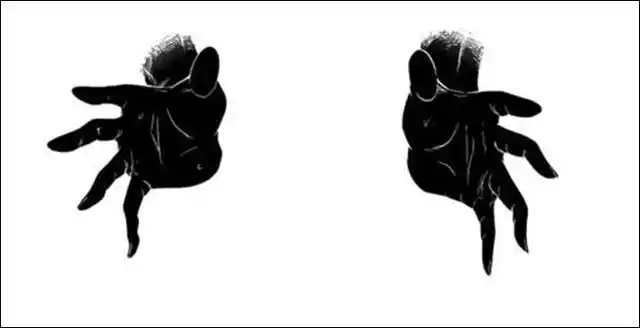 压疮伸向失能老人的黑手