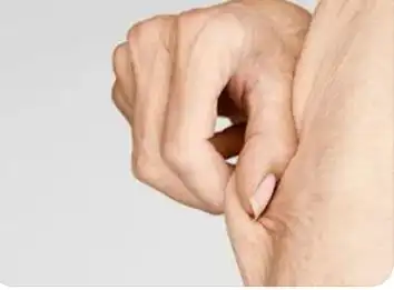 肚子皮肤松弛怎么变紧致了1