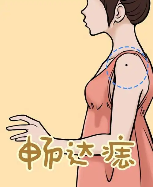 今天说说手臂上的痣,有这几种说明你艳福不浅,财运滚滚哦