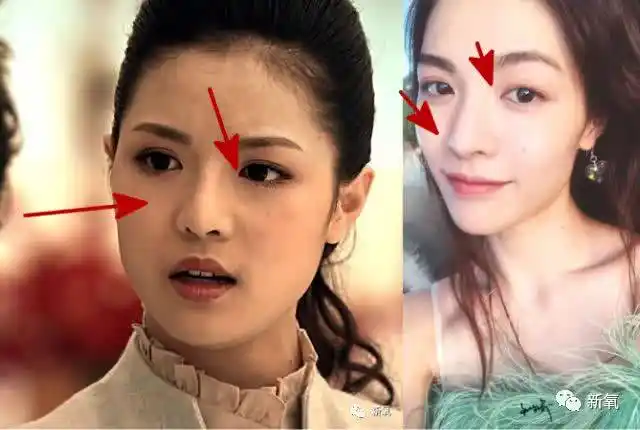 芳华女主钟楚曦这组整容前后的逆天对比照,把冯小刚的脸打肿了