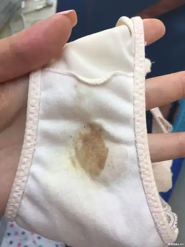 有经验的姐妹看看,孕早期褐色分泌物是咋回事?需要去医院吗?