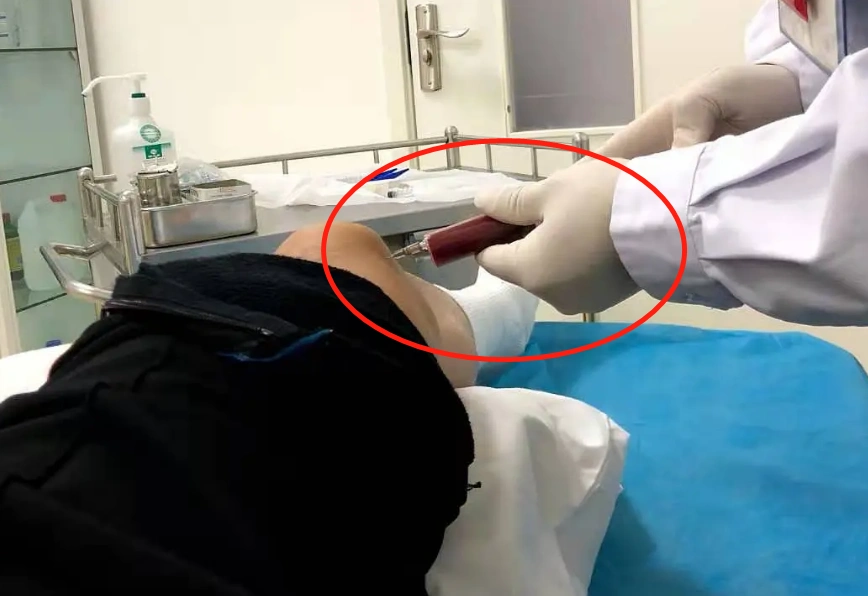 热爱运动的张哲瀚,膝盖有很严重的伤病