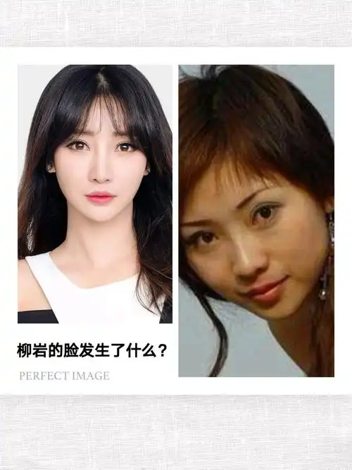 从首页的对比图就可以看出来柳岩的脸变得更精致了.