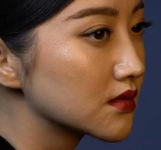 明星大量未修图曝光热巴毛孔闭口一堆杨幂皮肤松垮