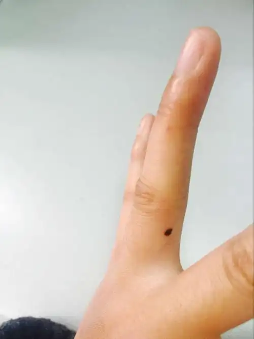 左手无名指下有一颗痣有没有什么说法