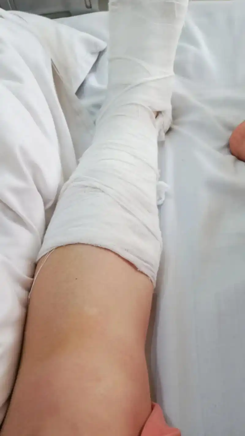 骨折第12天了,躺在病床上,笑着面对所有的苦难,相信自己只是 - 抖音