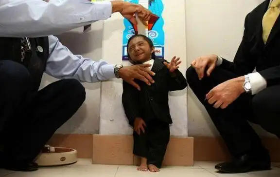 这个"全世界体积最小的宝宝",看了会让你忍不住皱眉头!