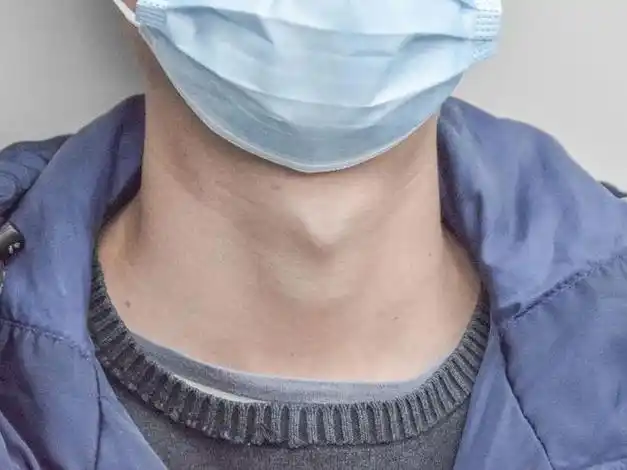 女孩的喉结,男孩的胸,太大了好像都不行?