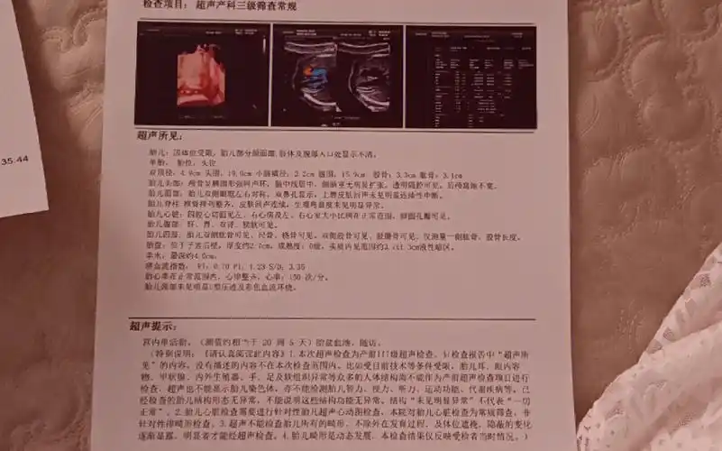 大排畸勉强通过但是胎盘血池