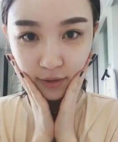 虽然否认整容,但雪梨还是大方承认自己打过瘦脸针和玻尿酸.