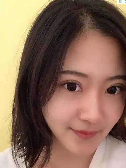 我个人是非常喜欢这种宽宽欧式大双眼皮的那个时候去医_圈子-新氧美容