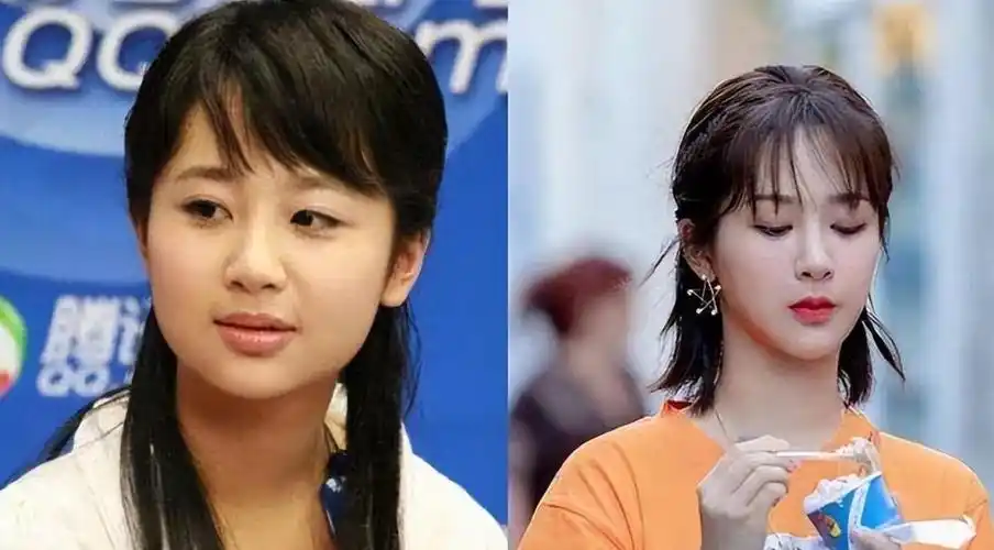 杨紫整容了吗杨紫有整容过是真的吗