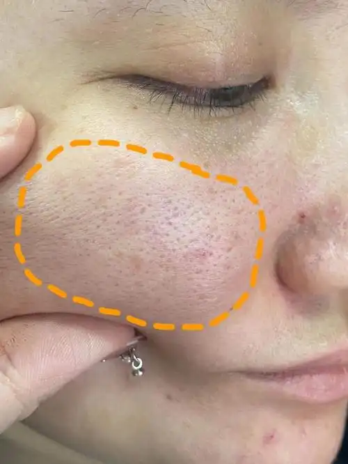 怎么修复角质层薄的问题?了解角质层的结构和功能