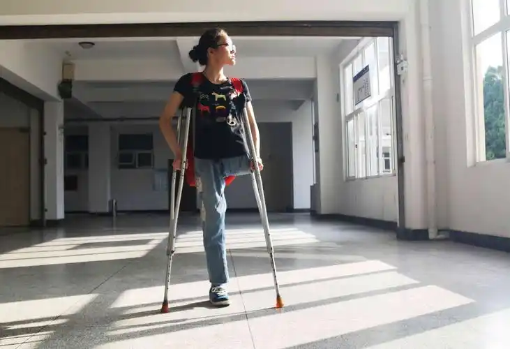 她独腿读大学生发奋活出自己是大家心中的乖乖女