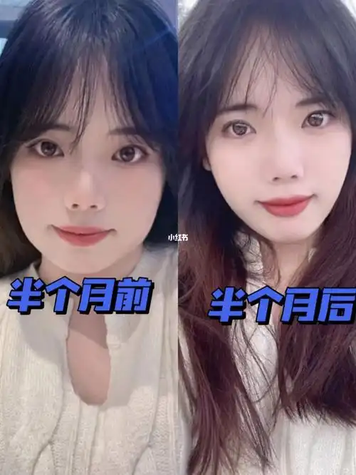 被大脸咬肌纠缠的兄弟姐妹注意啦,昔日的大饼脸已经被我成功甩掉了