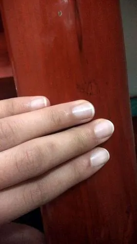 手指甲白怎么回事