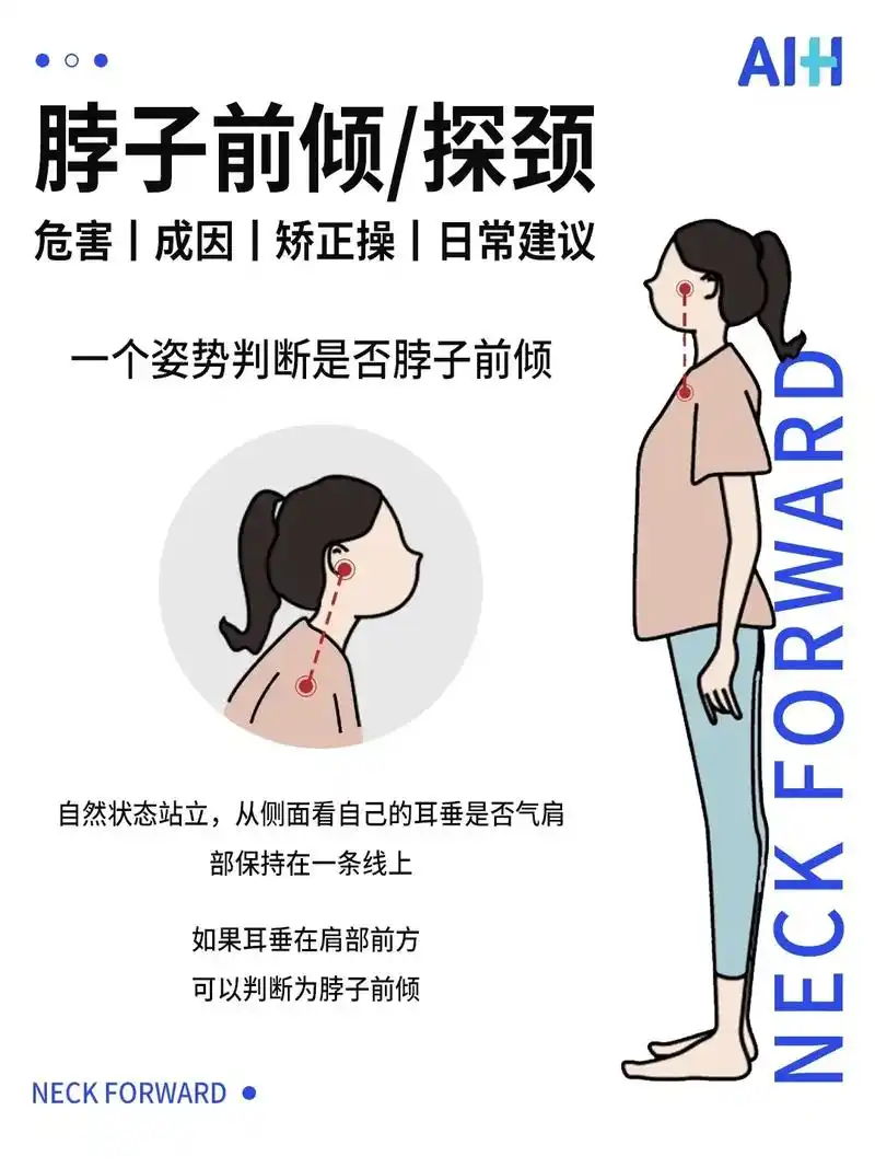 如何矫正脖子前倾(内附日常建议)如果把人体看成一根弹簧,给头 - 抖音