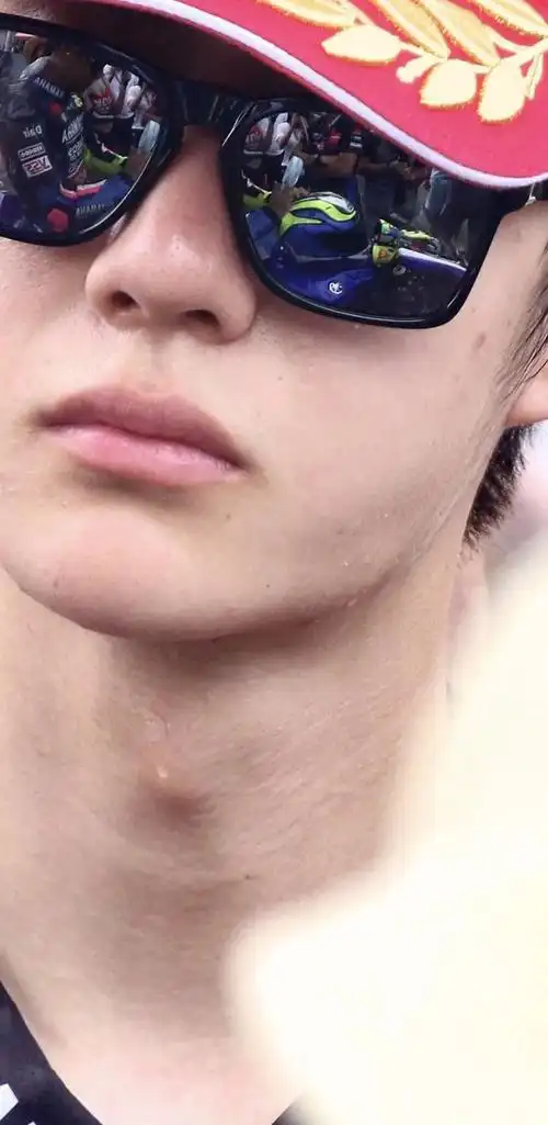 网友:王一博素颜贴脸照皮肤好好~但是好像看到了鼻翼切口